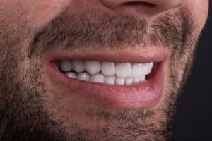smile makeover cosmetic dentist dental implants dentures
